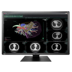 RadiForce RX660