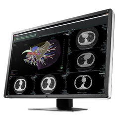 RadiForce RX660